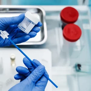 Peripheral Smear